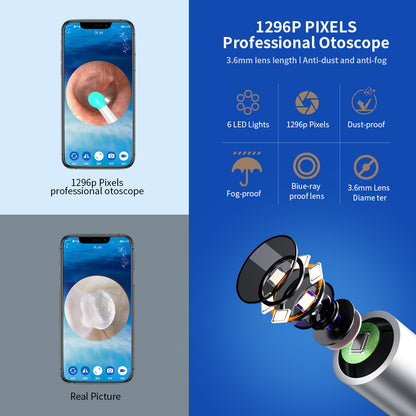 Wireless Ear Wax Removal Cleaner Intelligent Visual Ear Spoon Camera HD Video Otoscope Earwax Cleaning Endoscope Earpick